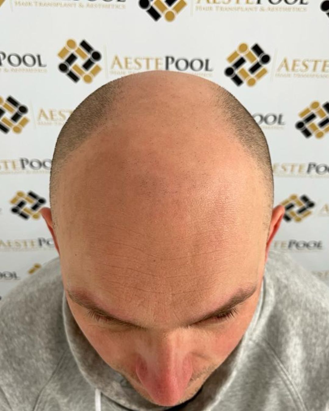 TJ1
