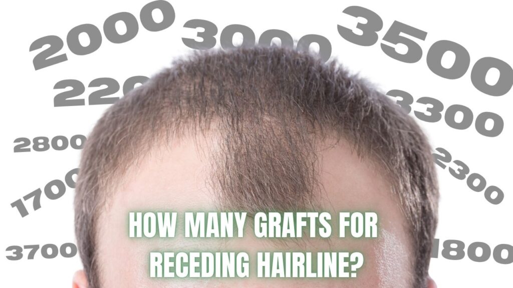 RECEDING_HAIRLINE